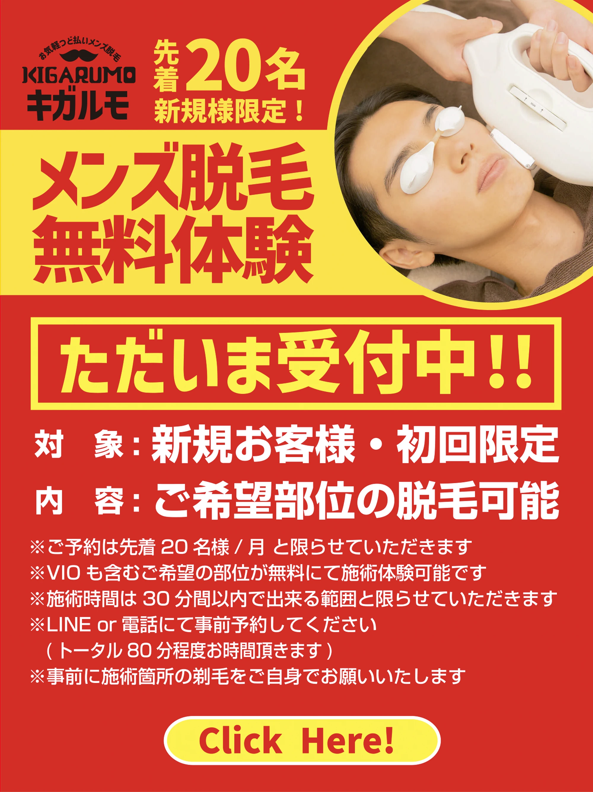 先着20名新規様限定 メンズ脱毛無料体験